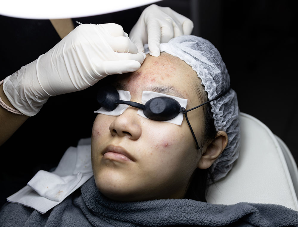 Young woman lying on bed doing facial skin care